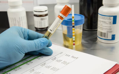PVEM propone que candidatos a cargos públicos se sometan a prueba antidoping