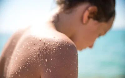 La pigmentación de la piel por el sol no representa riesgo a la salud siempre y cuando no haya exposición crónica: Dermatólogo