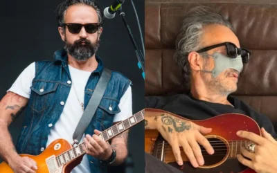 Tito Fuentes de Molotov revela secuelas de adicciones y cirugías reconstructivas