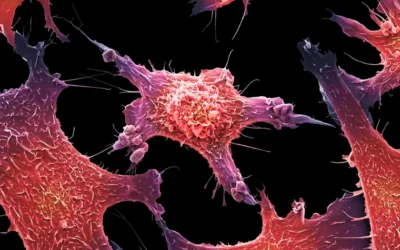 Así es el cáncer en etapa 0: el aviso silencioso del cuerpo que podría salvarte la vida