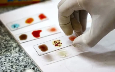 Científicos intentan cultivar «sangre dorada»: el tipo sanguíneo más raro y valioso del mundo