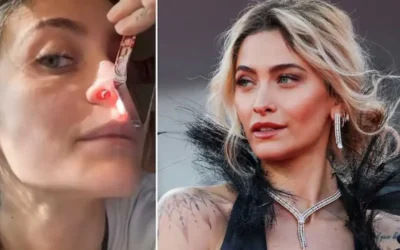 Paris Jackson muestra las secuelas que le dejó su pasado con las drogas
