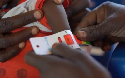 Unicef alerta que más del 50% de niños de cinco años sufren desnutrición aguda en Darfur Norte