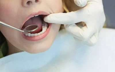 Hace falta mayor cultura en la revisión periódica dental en niños: Odontóloga