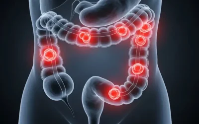 El cáncer colorrectal se convirtió en la principal causa de muerte oncológica en menores de 50 años en EE.UU.