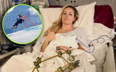 “Salvaron mi pierna de ser amputada”: Esquiadora Lindsey Vonn tras su grave lesión en los Juegos Olímpicos de Invierno