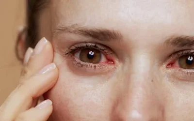 Llama Oftalmóloga  a proteger la vista en playas y balnearios durante temporada vacacional