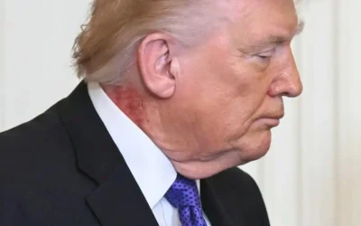 Trump genera alerta por salpullido rojo en el cuello durante acto en la Casa Blanca