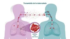 Bajo control endémico la tuberculosis en Ahome; suman 52 casos en lo que va del 2026